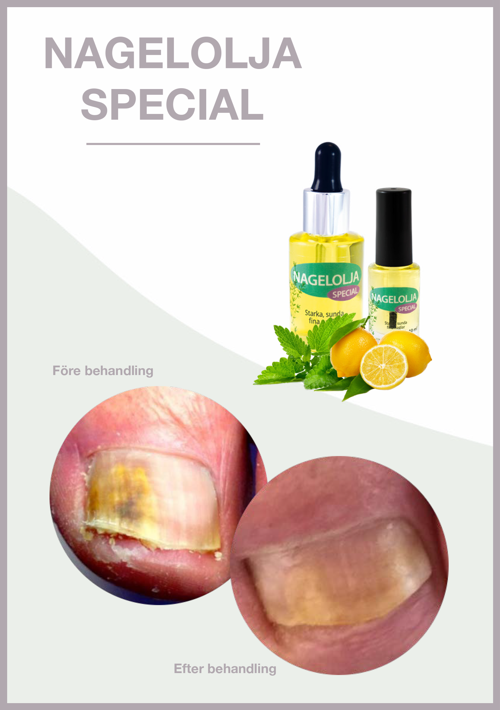 Nail Oil Special - 10 ml - Til tørre og sprøde negle