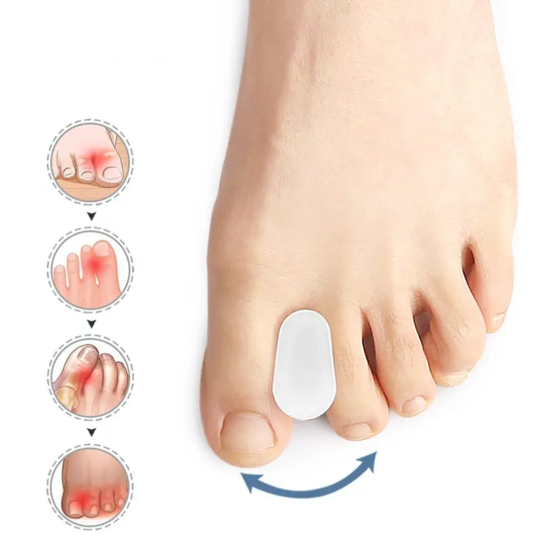 Tåspreder til hallux valgus - 2 stk. - Adskiller tæerne for at reducere smerte - Medium (Skostorlek: 38-42)